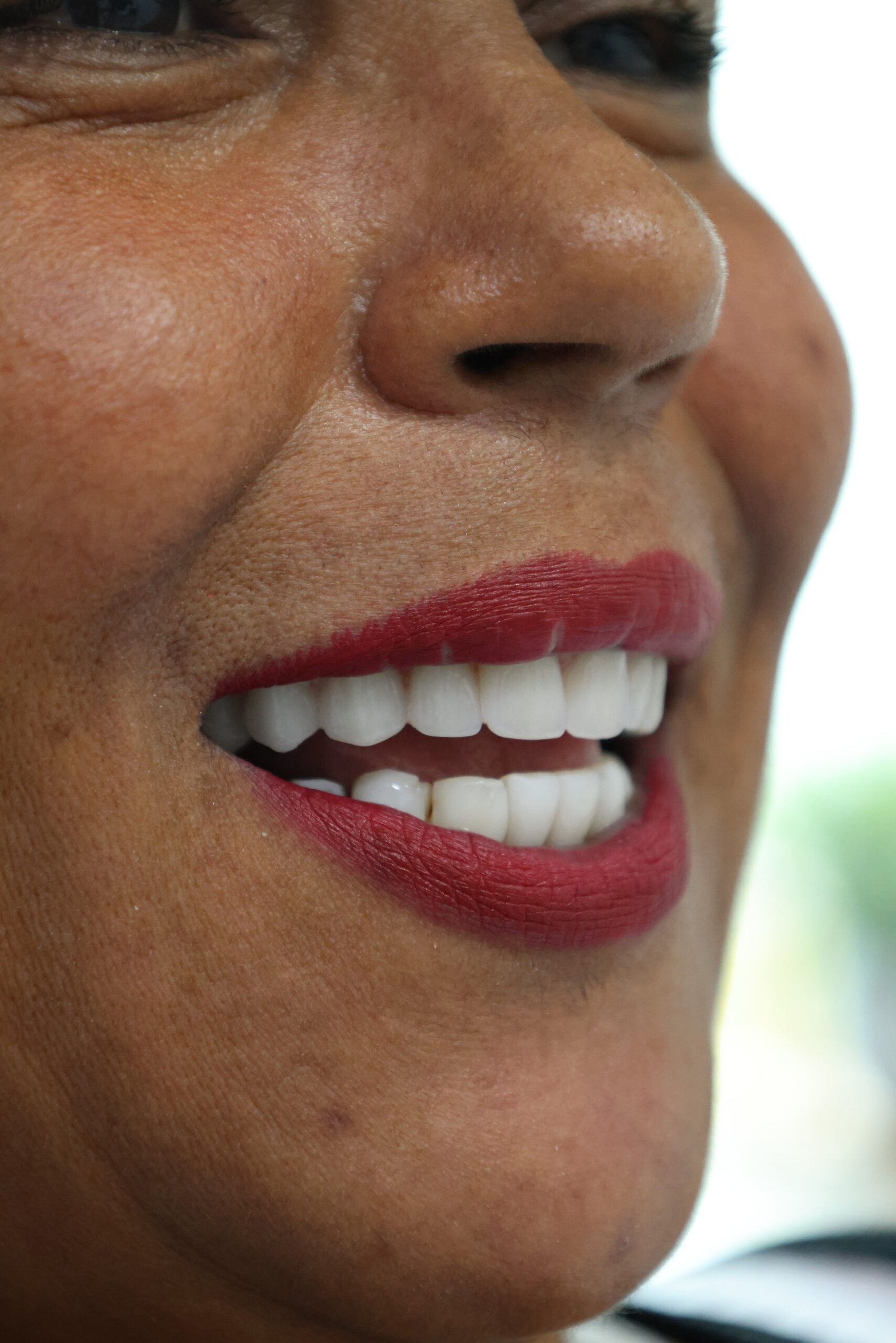 Sandreani Palhetta - Protese protocolo 48h